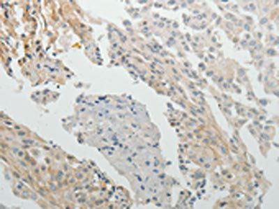 SPATA17 Antibody