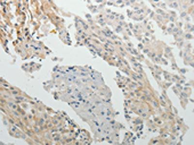 SPATA17 antibody