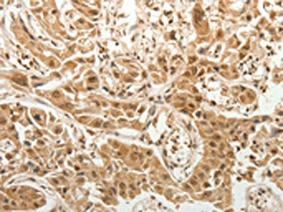SPATA17 Antibody