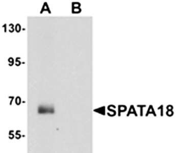 SPATA18 Antibody