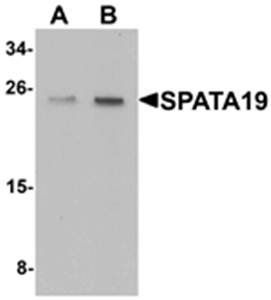 SPATA19 Antibody