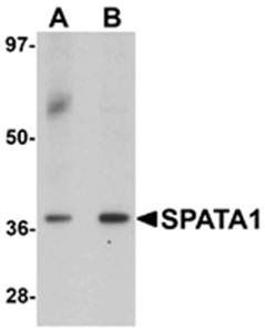 SPATA1 Antibody
