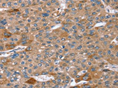 SPATA5L1 antibody