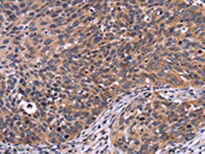 SPATA7 Antibody