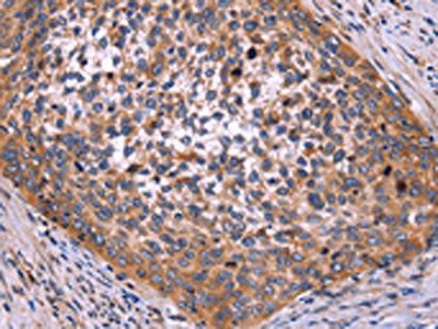 SPATA7 Antibody