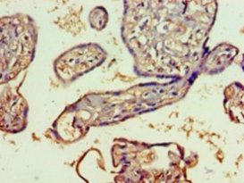 SH3GLB2 Antibody
