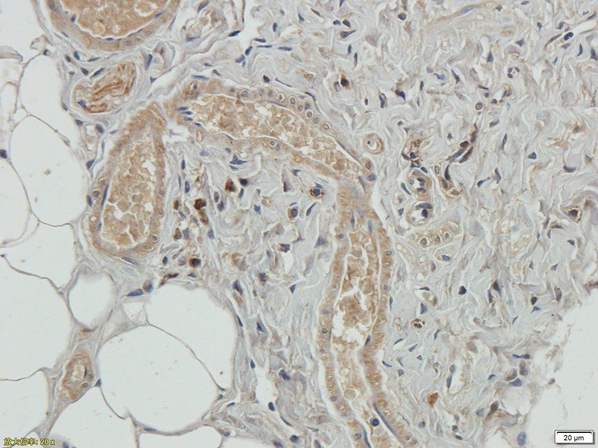 SPC18 Rabbit Polyclonal Antibody