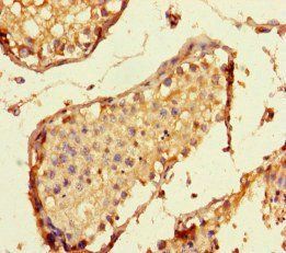 SPC24 Antibody