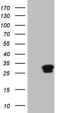 SPC25 antibody