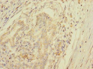 SPC25 Antibody