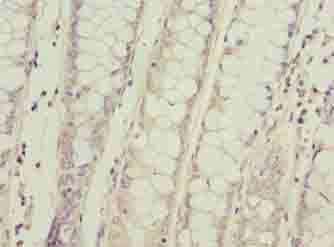 SPCS2 Antibody