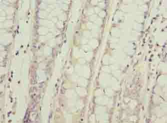 SPCS2 antibody