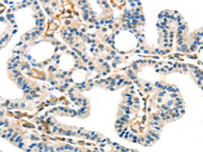 SPDL1 Antibody