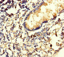 Spermidine synthase antibody