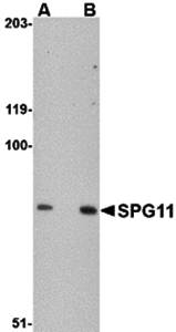 SPG11 Antibody