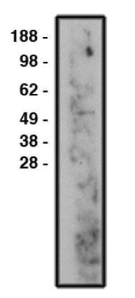 Sphingomyelin Phosphodiesterase 3 antibody