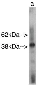 Rabbit anti Human Sphingomyelin synthase-related protein 1