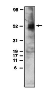 Mouse anti Human Sphingosine 1 Phosphate 4 Receptor (CT) (EDG6)