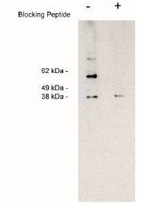 Sphingosine Kinase 2 antibody