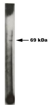 Sphingosine Kinase 2 antibody