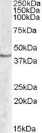 Goat anti-SPHK1 Antibody