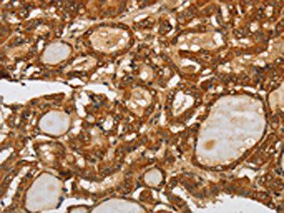SPHK2 Antibody