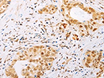 SPIN2B Antibody