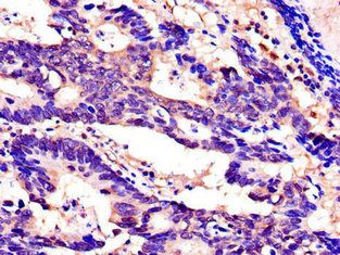 SPINK1 Antibody
