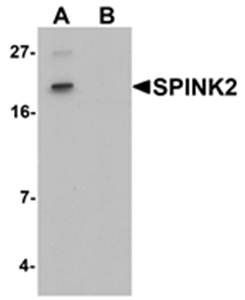 SPINK2 Antibody
