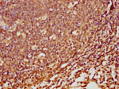 SPINK5 Antibody