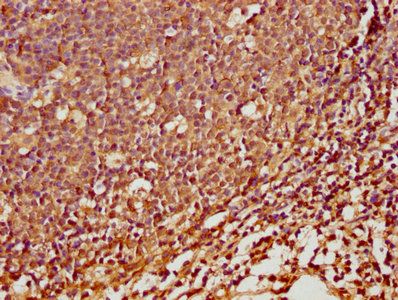 SPINK5 antibody