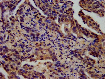SPINK6 Antibody