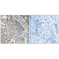 SPINK6 antibody