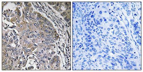 SPINK6 Antibody