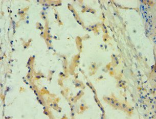 SPINT1 antibody