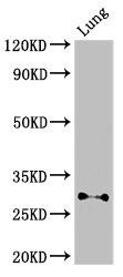 SPINT2 Antibody