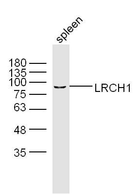 LRCH1 antibody