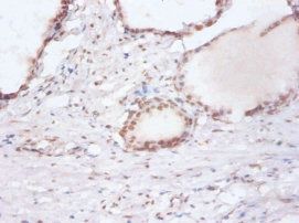 DDX39B Antibody