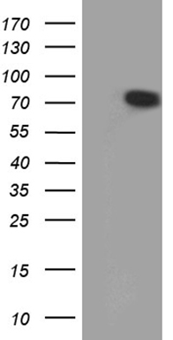 splicing factor 1 (SF1) antibody