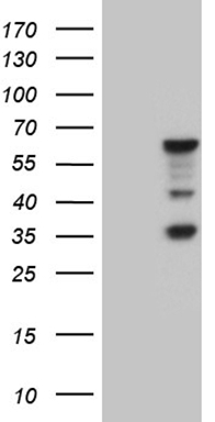 splicing factor 1 (SF1) antibody