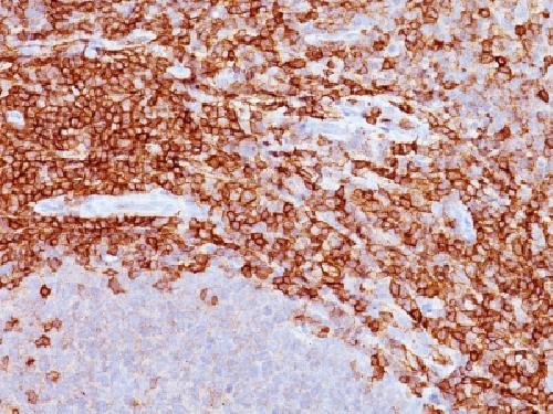SPN Antibody