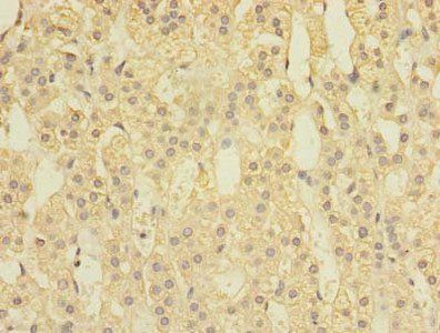 SPOP Antibody