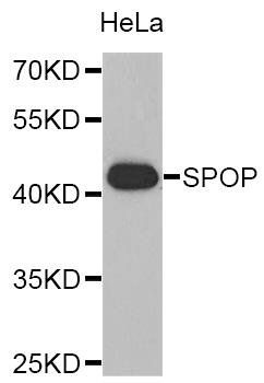 SPOP antibody