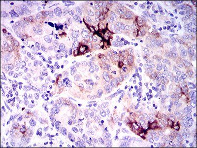 SPP1 Antibody