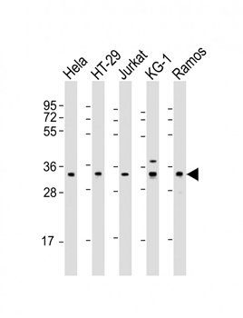 SPPL2B antibody
