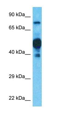 SPPL2C antibody