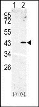 SPPL3 antibody
