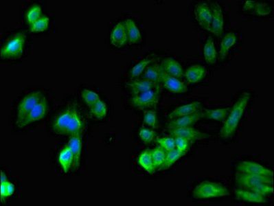 SPPL3 Antibody