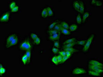 SPPL3 antibody