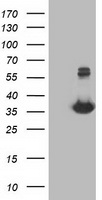 SPR antibody